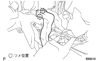 E065010