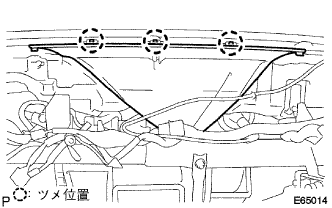 E065014